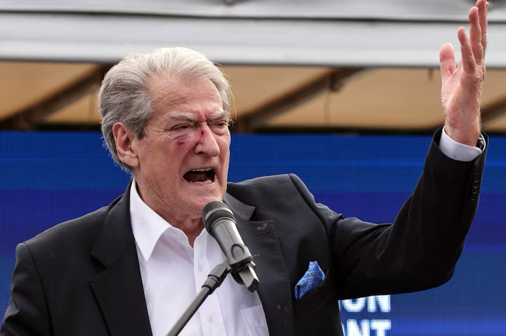 Ông SaliBerisha, lãnh đạo Đảng Dân chủ trung hữu đối lập An-ba-ni, phát biểu sau khi ông bị tấn công trong một cuộc biểu tình chống chính phủ được tổ chức gần Hội nghị thượng đỉnh của các nhà lãnh đạo Liên minh Châu Âu và những người đồng cấp từ Tây Balkan ở thủ đô Tirana, An-ba-ni, ngày 06/12/2022. (Ảnh AP/Franc Zhurda, File)